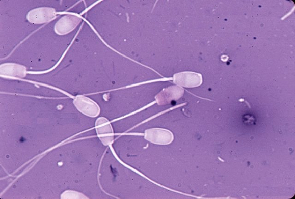 Инфекционный фактор в репродуктивной функции КРС